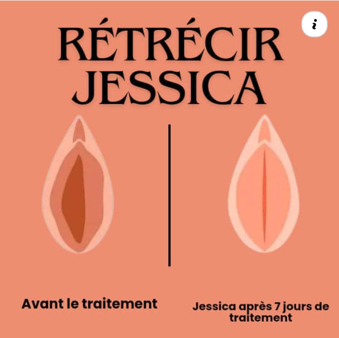JESSICA SERRER (rétrécir le vagin améliore le plaisir vaginal féminin des femmes)